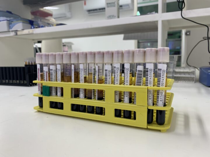 Hemocentro passa a realizar teste para detectar malária em sangue doado