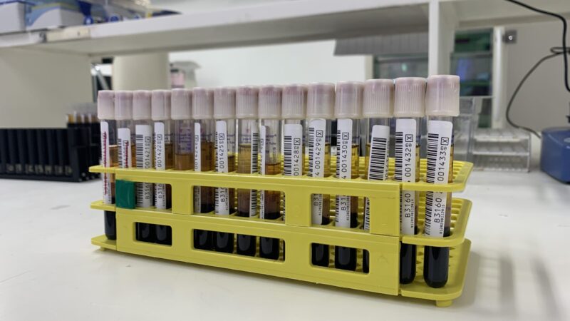 Hemocentro passa a realizar teste para detectar malária em sangue doado