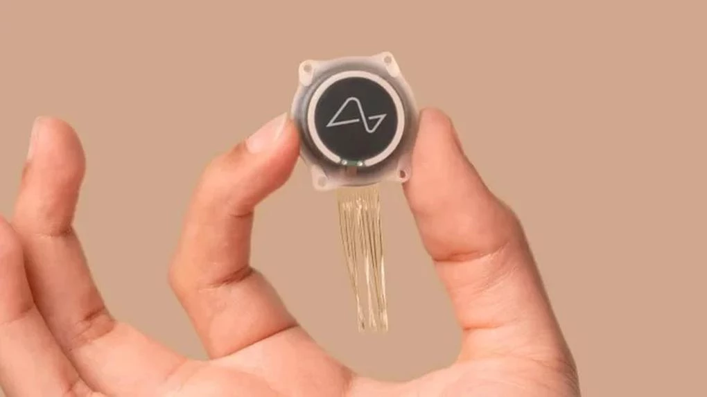 Elon Musk anuncia primeiro implante de chip cerebral humano