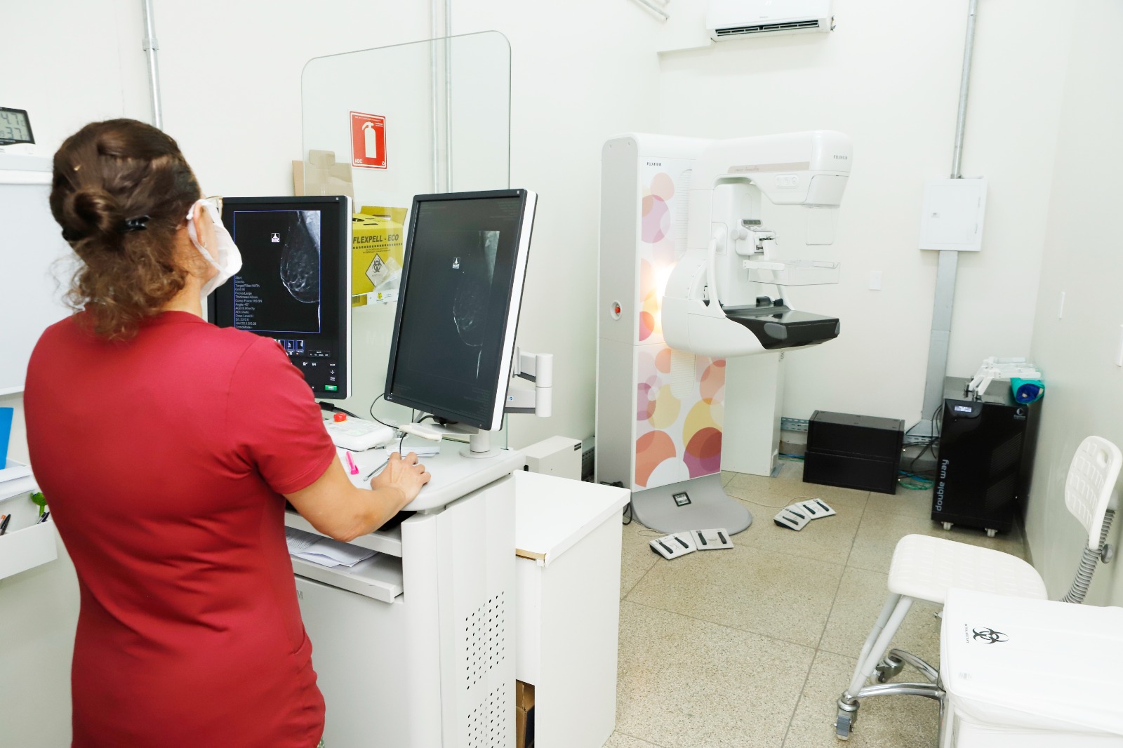 Mamografia: a arma essencial na luta contra o câncer de mama