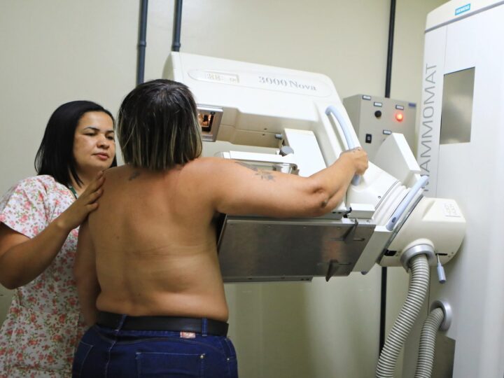 DF avança no combate ao câncer de mama com novas tecnologias e serviços