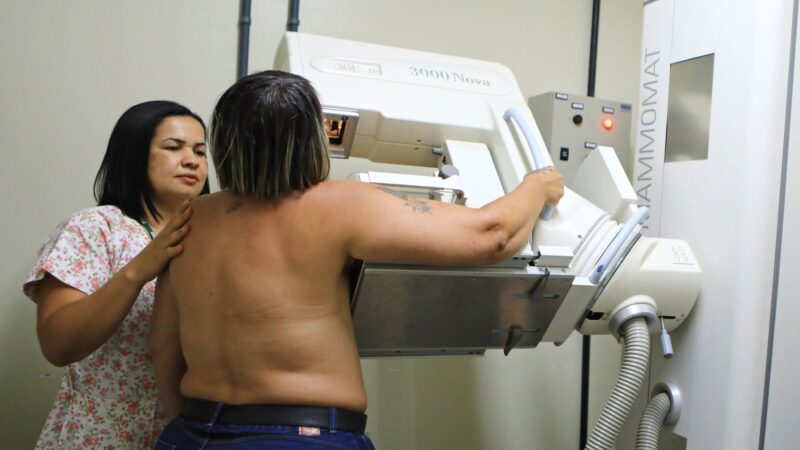 DF avança no combate ao câncer de mama com novas tecnologias e serviços