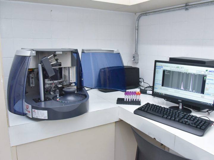 Hospital de Base ganha novo equipamento para agilizar diagnósticos