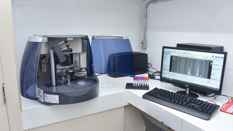 Hospital de Base ganha novo equipamento para agilizar diagnósticos