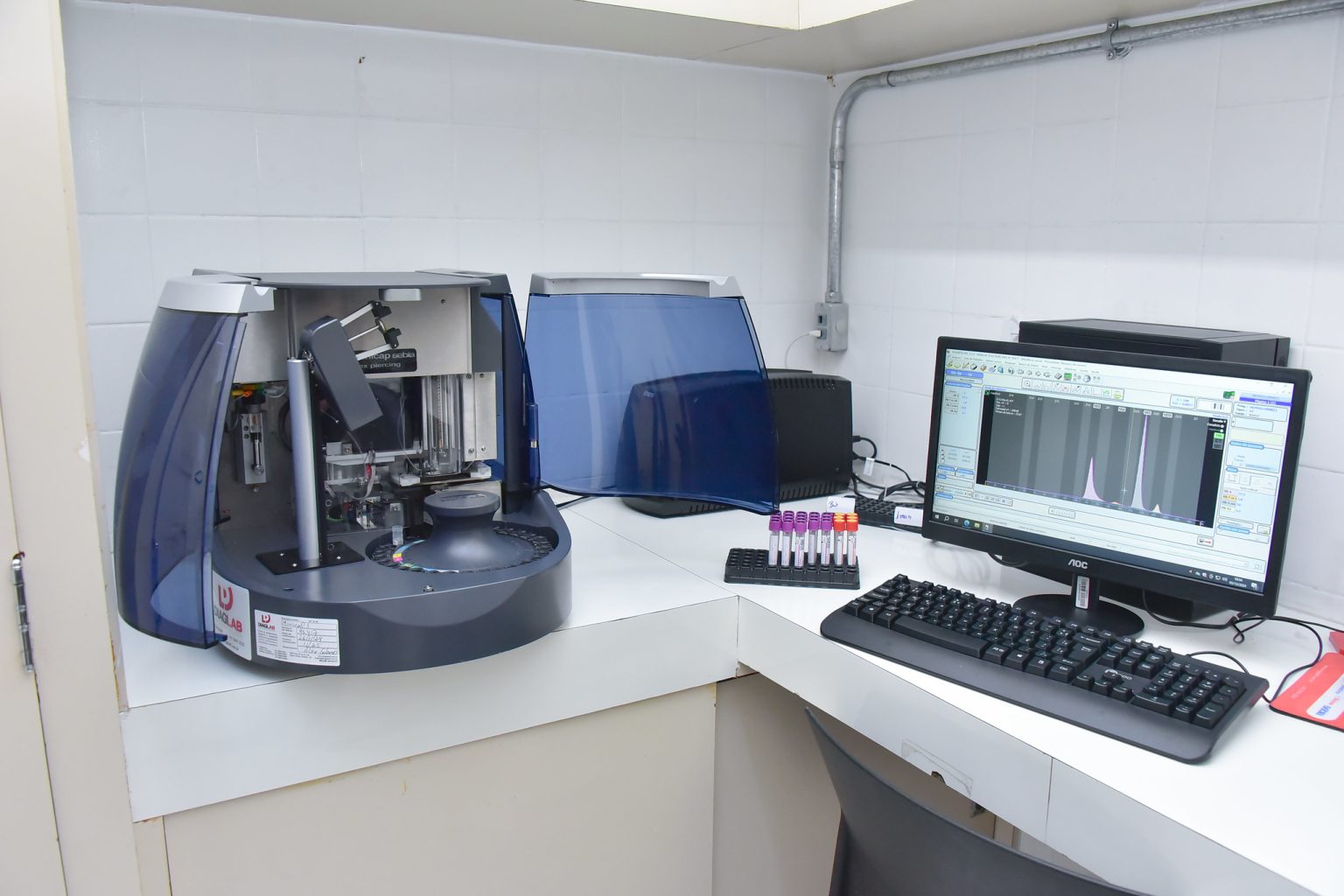 Hospital de Base ganha novo equipamento para agilizar diagnósticos