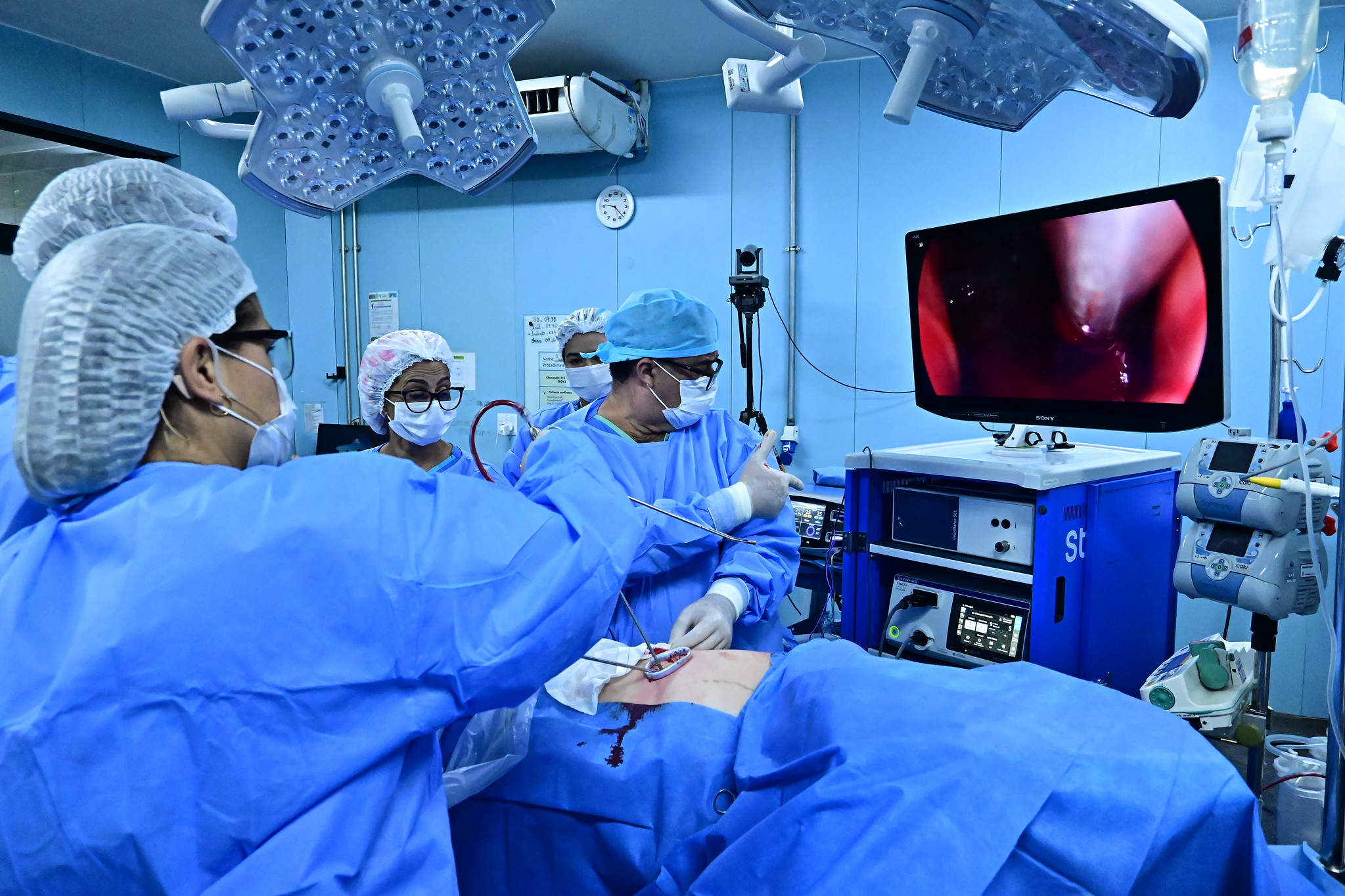 Hospital de Base inova com cirurgias torácicas 3D