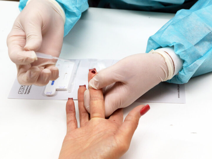 DF oferece testagem rápida contra o HIV no SCS