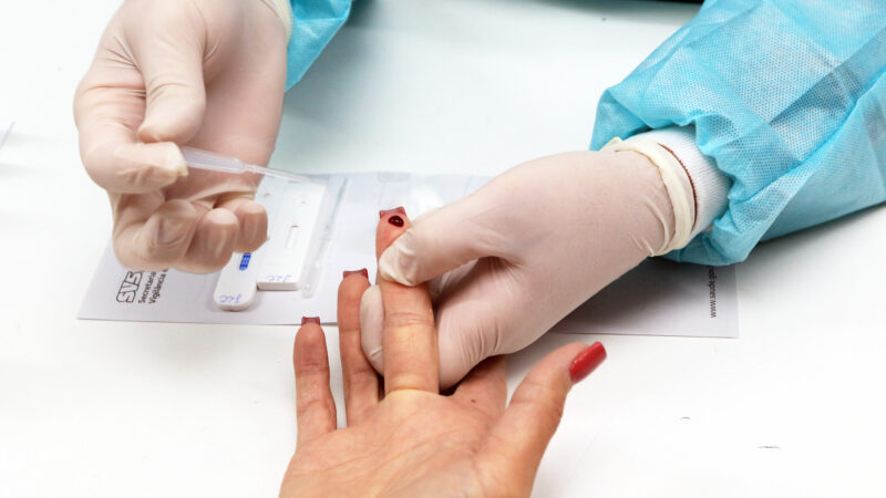 DF oferece testagem rápida contra o HIV no SCS