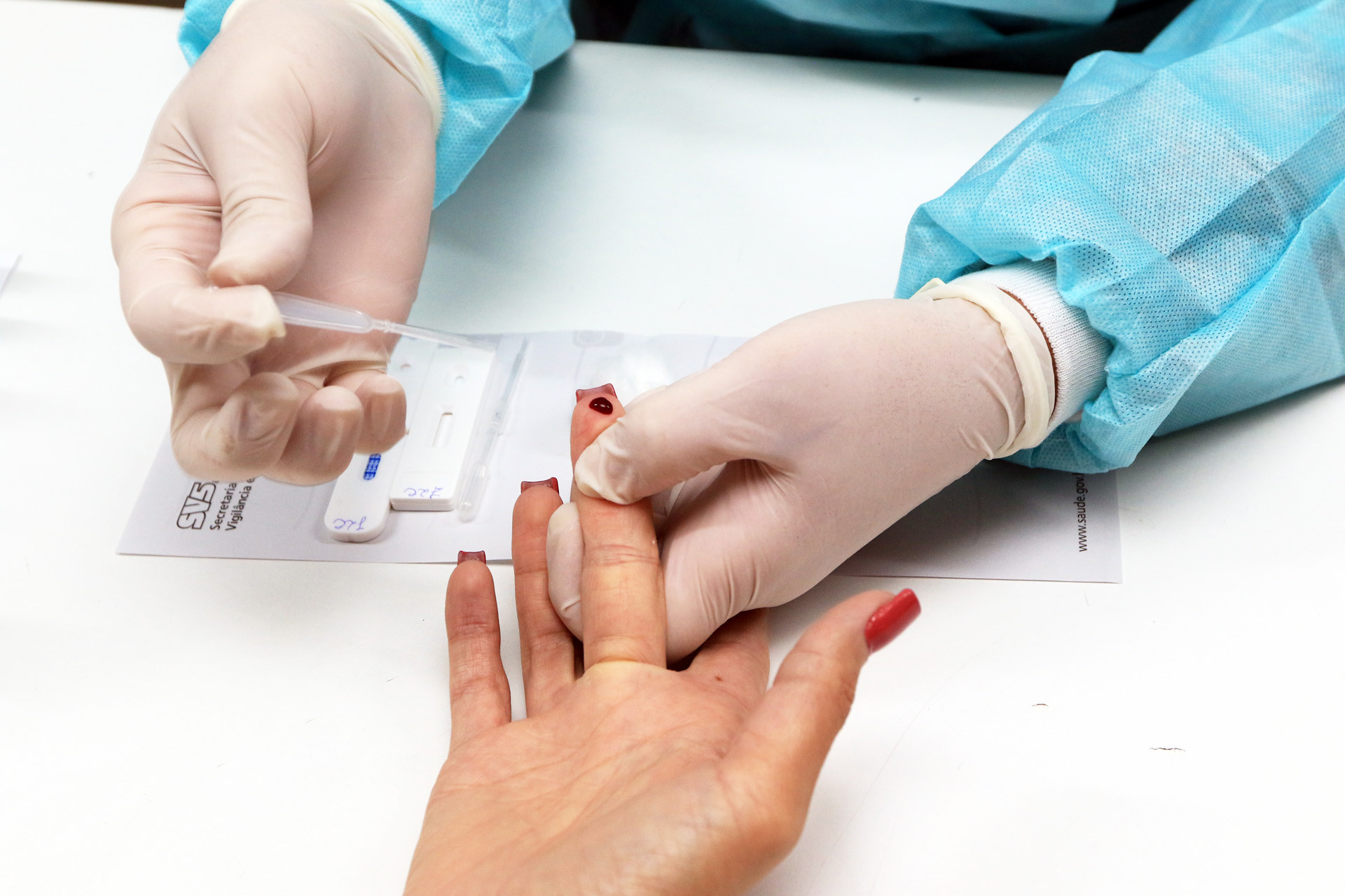 DF oferece testagem rápida contra o HIV no SCS