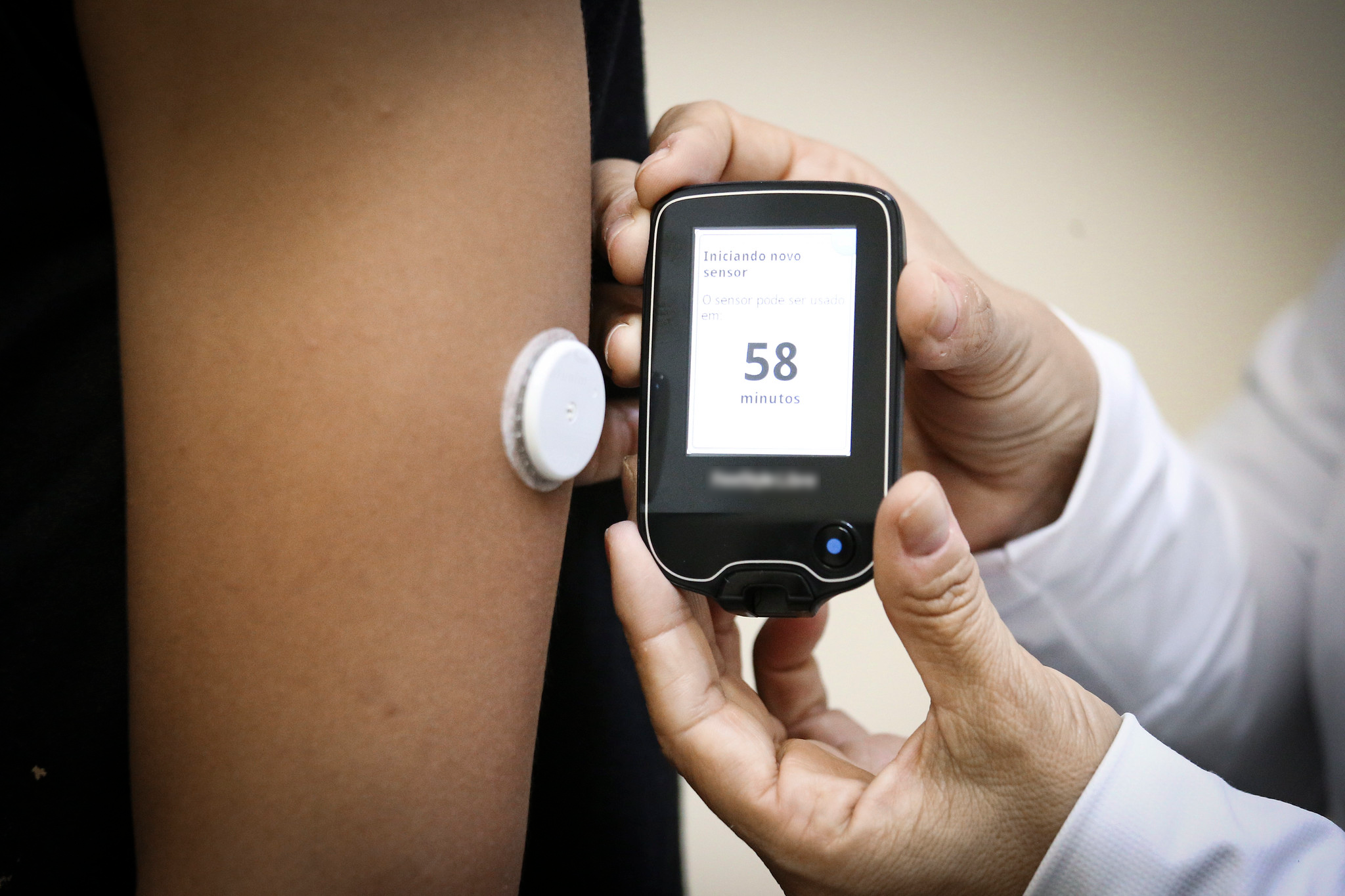 GDF investe R$ 7,2 milhões em sensores de glicose para diabéticos