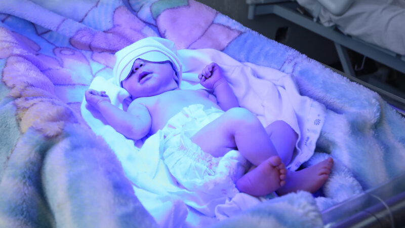 Maternidade do Hospital do Gama recebe novos equipamentos