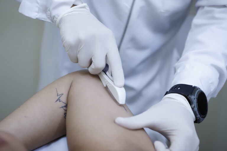 Método contraceptivo gratuito e reversível, o implanon age no corpo durante até três anos | Foto: Jhonatan Cantarelle/Agência Saúde DF