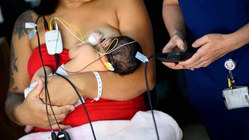 Hospital do Gama lança novo exame auditivo para recém-nascidos