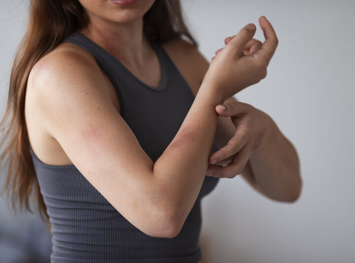 Verão acende alerta para Dengue, Zika e Chikungunya