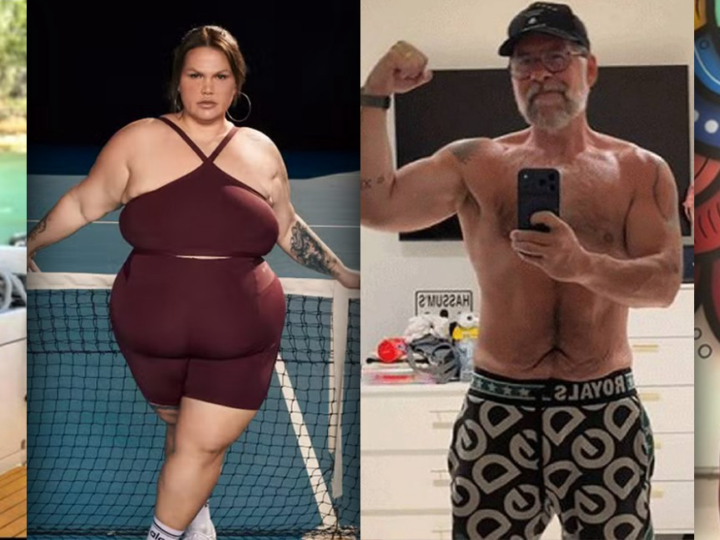 Cirurgia bariátrica não vai acabar, garante sociedade brasileira