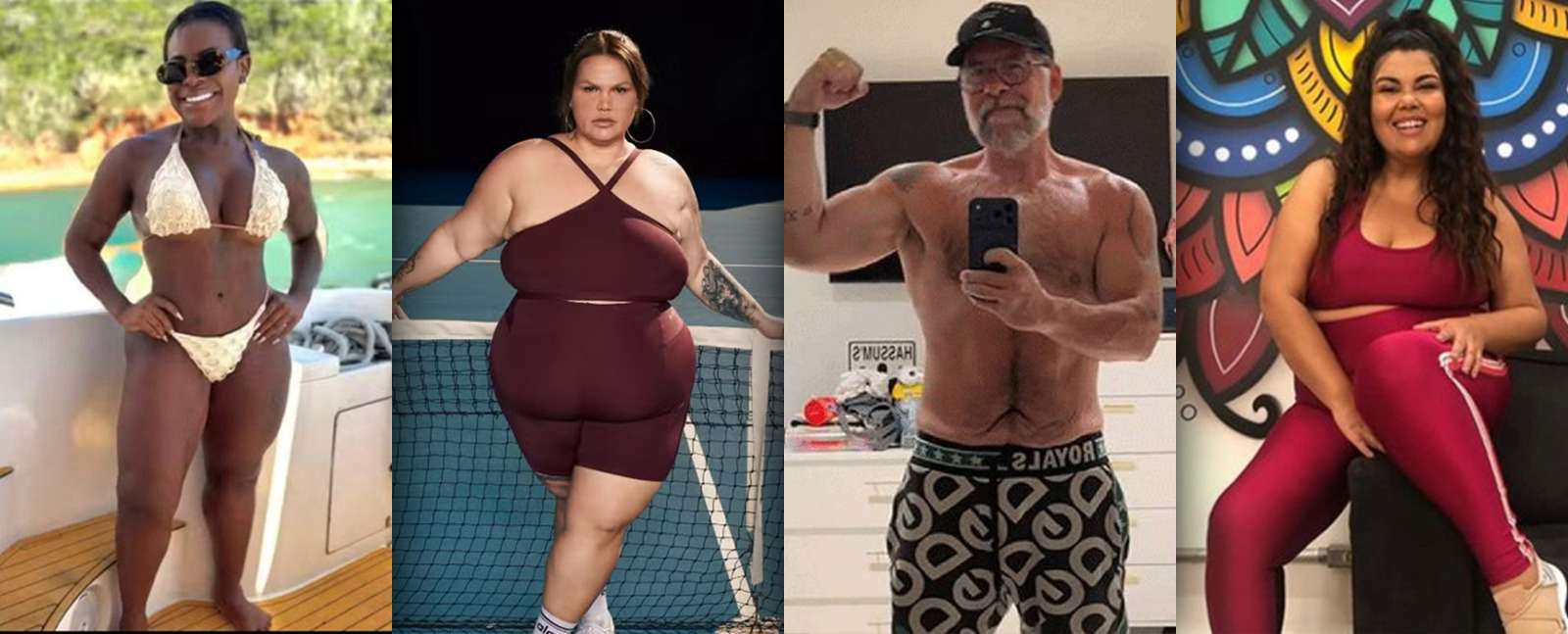 Cirurgia bariátrica não vai acabar, garante sociedade brasileira