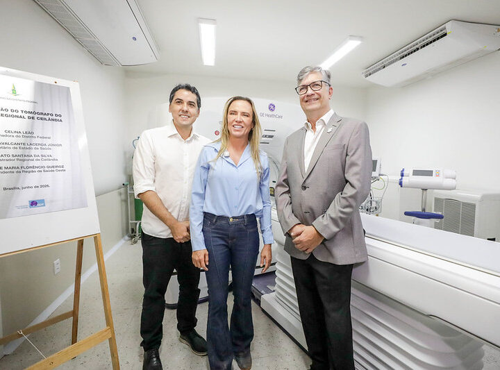 Tomógrafo com inteligência artificial chega ao Hospital