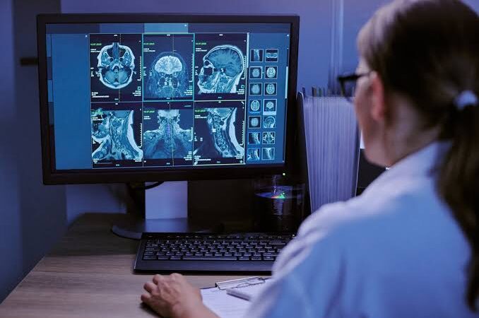 Aberta seleção para neurologia, psiquiatria e oftalmologia