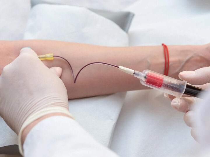 Exame de sangue para investigar Alzheimer chega ao Brasil