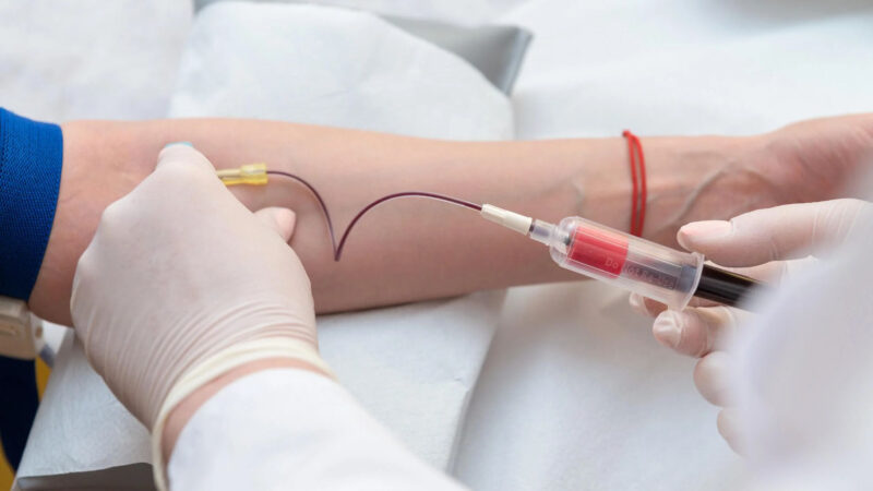 Exame de sangue para investigar Alzheimer chega ao Brasil