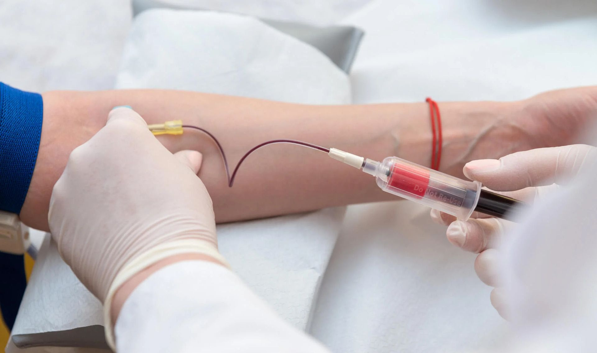 Exame de sangue para investigar Alzheimer chega ao Brasil